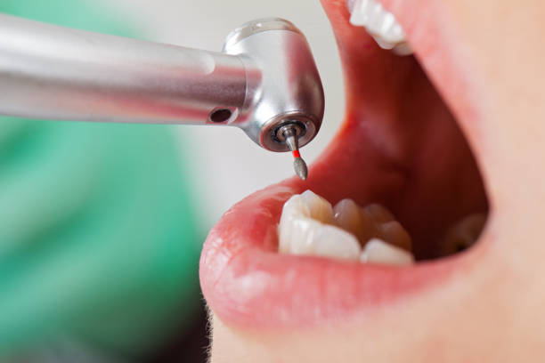 Best Emergency Treatment for Toothache in Westby, WI
